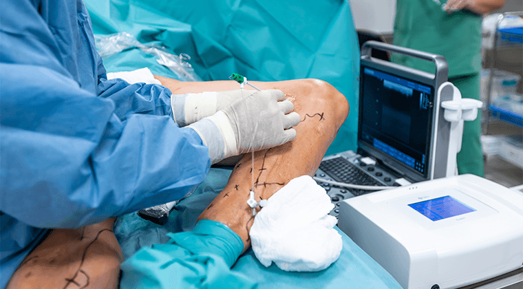 Cirugía de várices