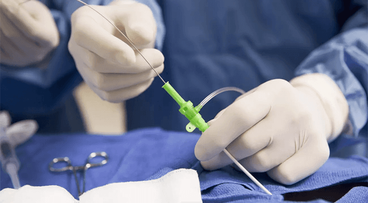 Reparación endovascular de aneurismas