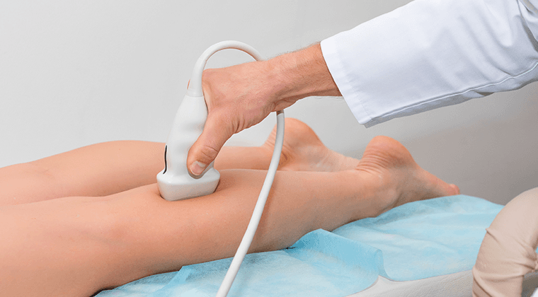 Ultrasonido Doppler vascular